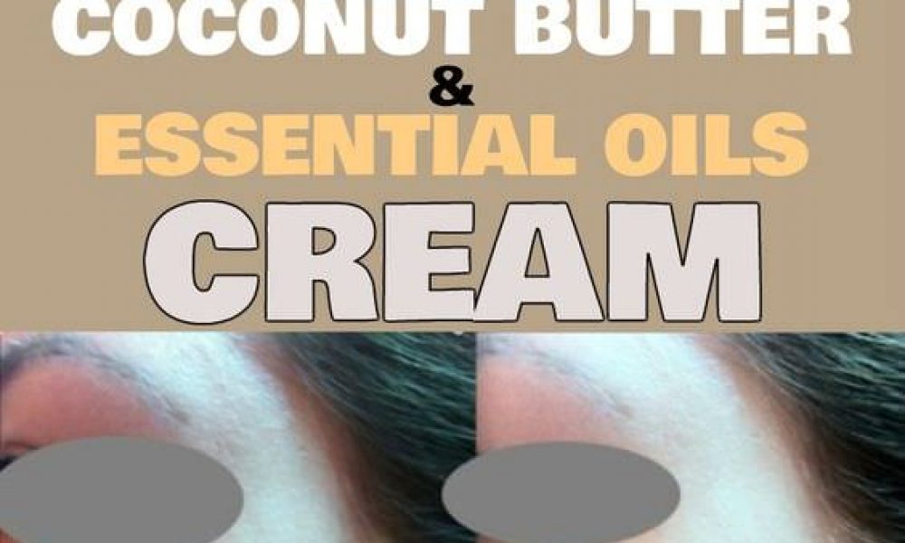 How to get rid of scars with coconut butter and essential oils cream