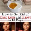 how-to-get-rid-of-dark-knees-and-elbows-in-10-days