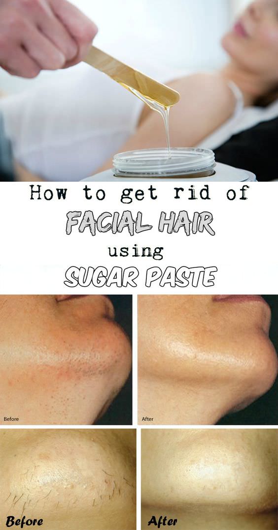 get-rid-of-facial-hair-using-this-natural-solution-fashion-daily