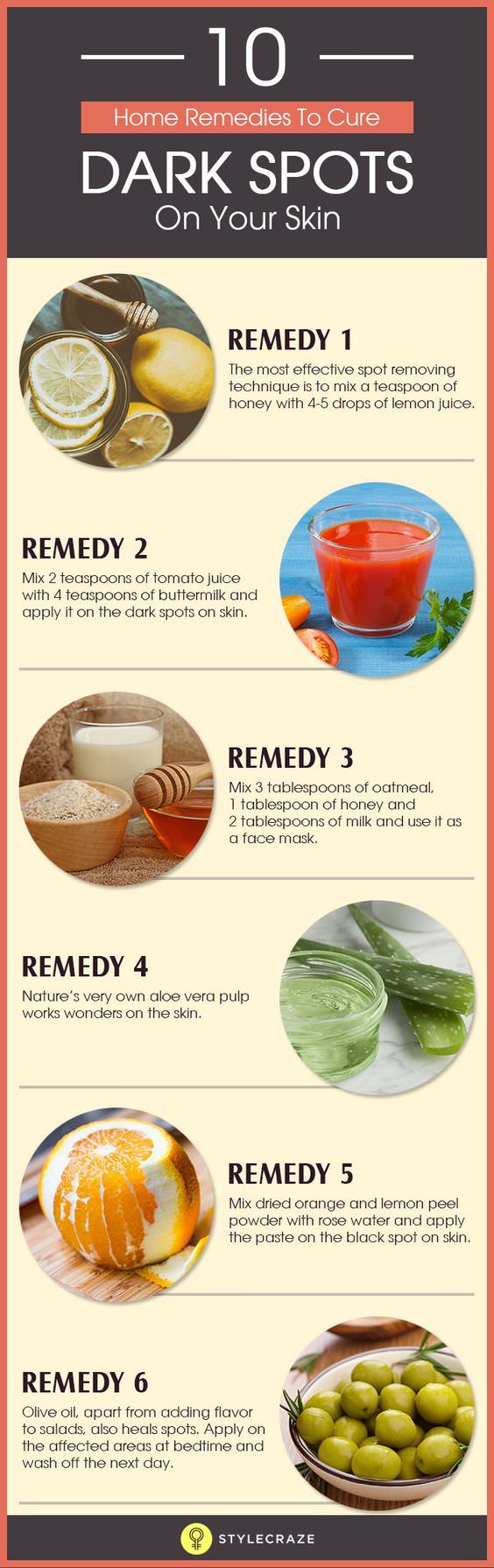 How To Remove Dark Spots On Face Natural Remedies