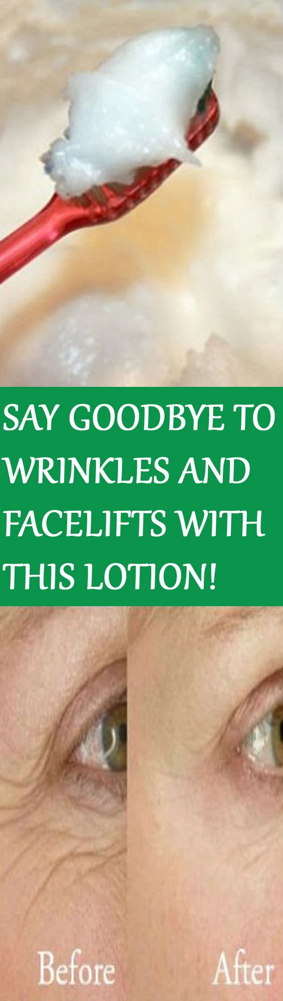 These two powerful ingredients can help you in reducing wrinkles and facelifts. No chemical, it's all natural. Check out the recipe!