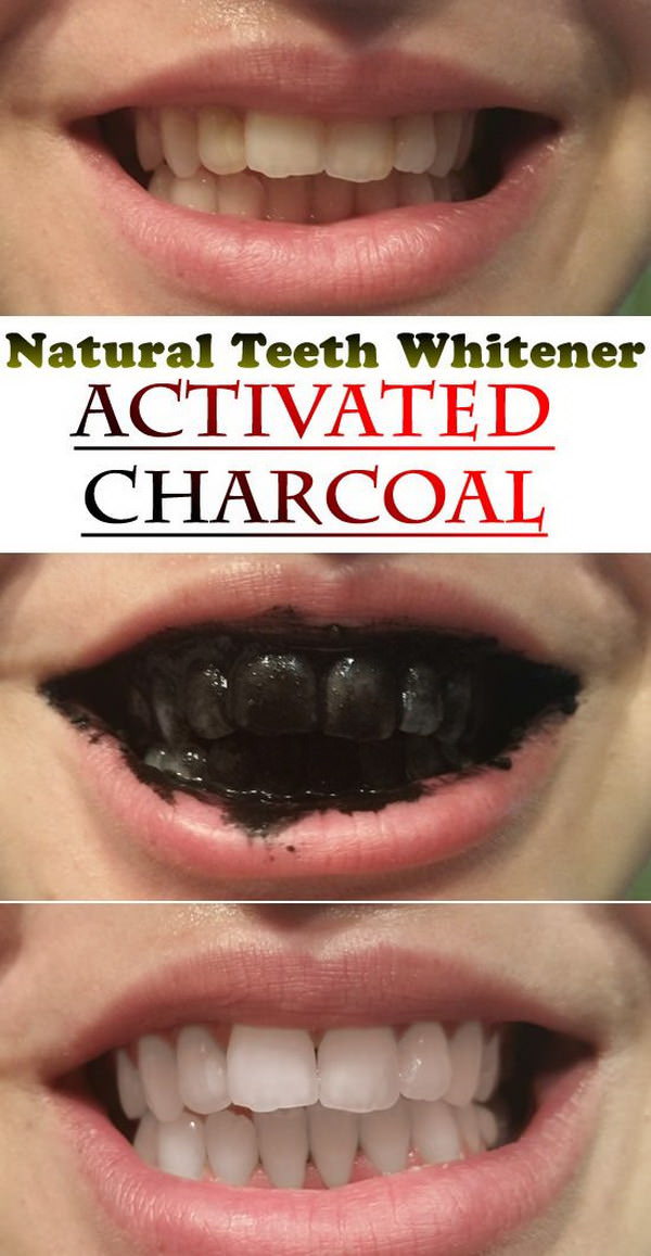 15 NATURAL Ways to Whiten Your Teeth: Homemade Teeth Whiteners - Fashion Daily