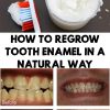 how-to-regrow-tooth-enamel-in-a-natural-way
