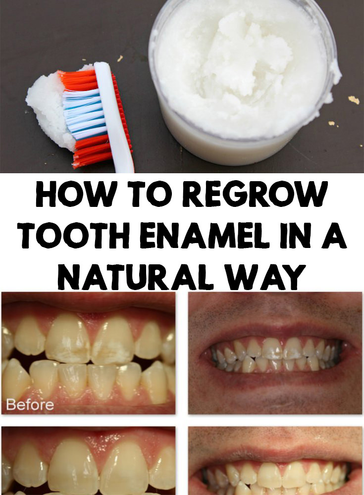 How To Regrow Tooth Enamel In a Natural Way - Fashion Daily