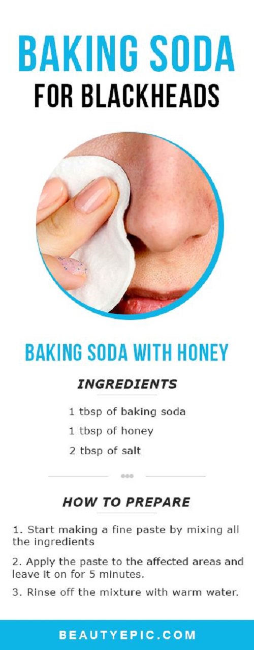 Though blackheads are nothing to worry about, but who doesn’t want a clear and flawless skin? Try these simple and effective remedies with baking soda.