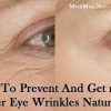 Under Eye Wrinkles