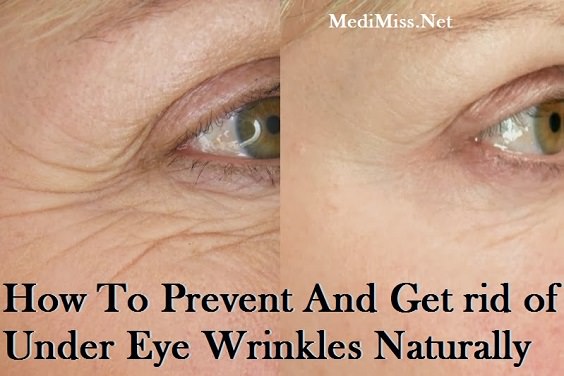 Best home remedies to get rid of fine lines under eyes.